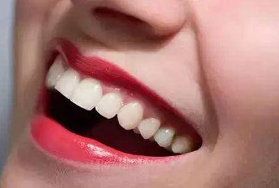 牙齿美白后怎样护理？常见的牙齿美白的方法