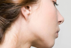 北京鼻部整形手术贵不贵  有什么副作用？