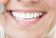 牙齿矫正的较佳年龄  美容冠修复牙齿怎么样？
