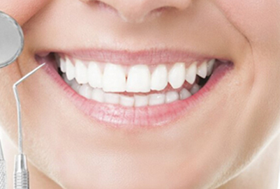 牙齿矫正的较佳年龄 美容冠修复牙齿怎么样