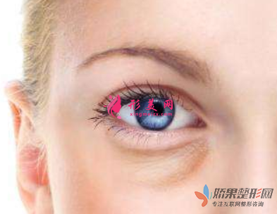 手术祛眼袋效果可以保持多久？