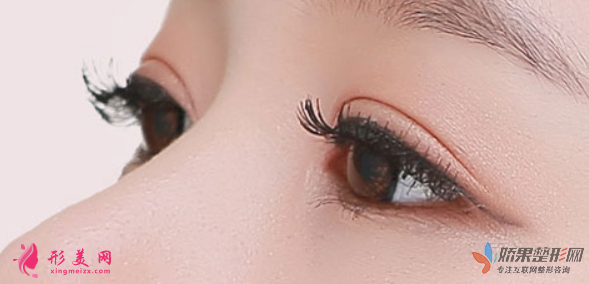 全切双眼皮感染的症状有哪些