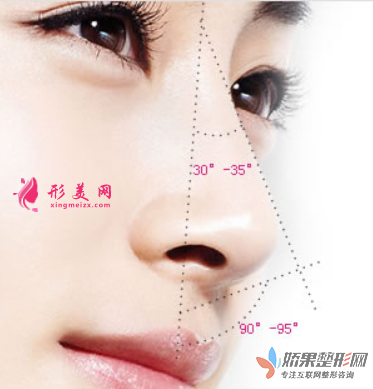 上海整形医院软骨隆鼻费用是多少？