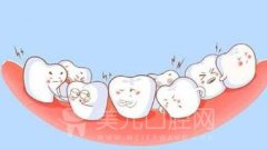 做矫正牙齿隐形疼不疼？会影响吃东西吗？