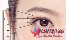 郑州整形医院双眼皮整形价格需要多少钱？